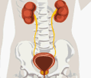Insuficiencia renal crónica
